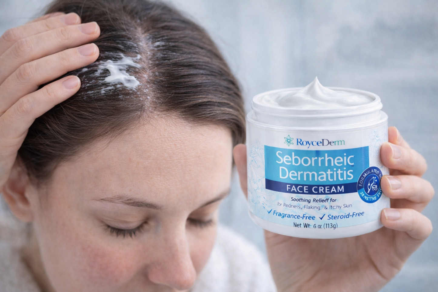 RoyceDerm Seborrheic Dermatitis